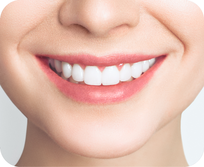Smile Well Dental Langley Dental Services
