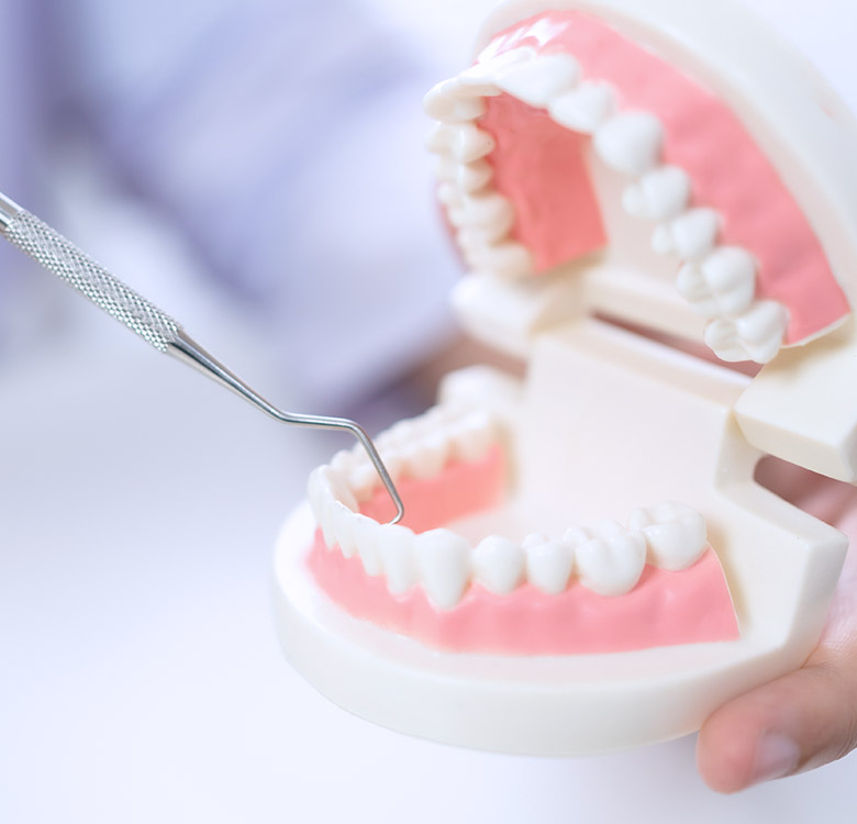 TMJ & Orofacial pain - Smile Well Dental Langley