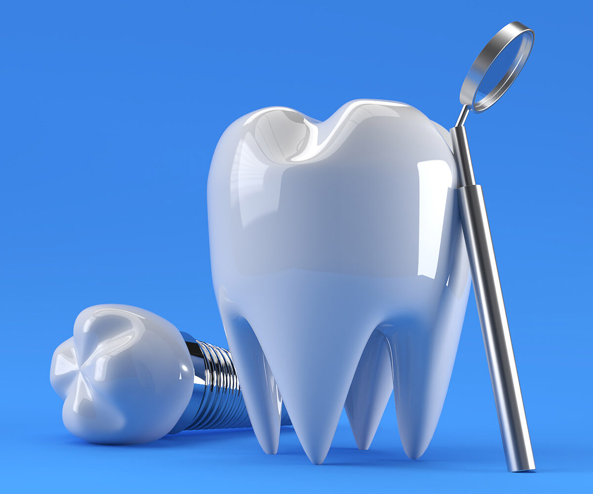 Smile Well Dental Langley - Implant